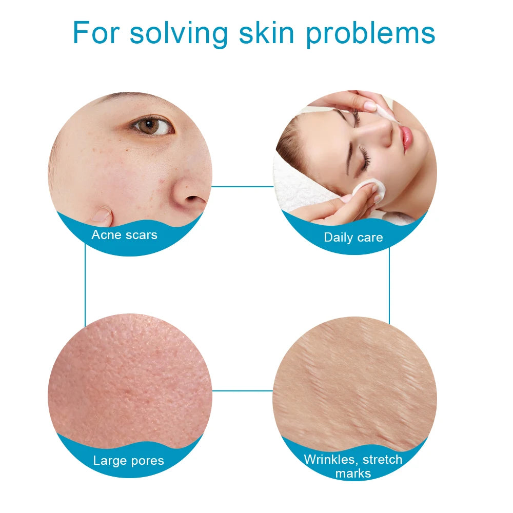 Microneedle Derma Roller for Hair and Facial Skin Care